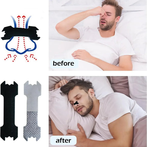 NOVS™ Advanced Nasal Strips for Better Breathing